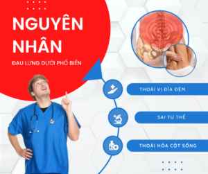 Đau Lưng Dưới: Nguyên Nhân, Triệu Chứng, Cách Trị Tại Nhà 42