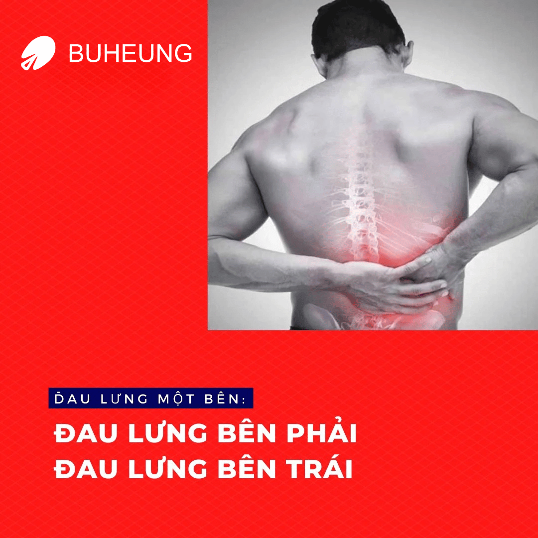 5 Nguyên Nhân Gây Đau Lưng Một Bên: Đau Lưng Bên Phải, Bên Trái 1 5 Nguyên Nhân Gây Đau Lưng Một Bên: Đau Lưng Bên Phải, Bên Trái 1