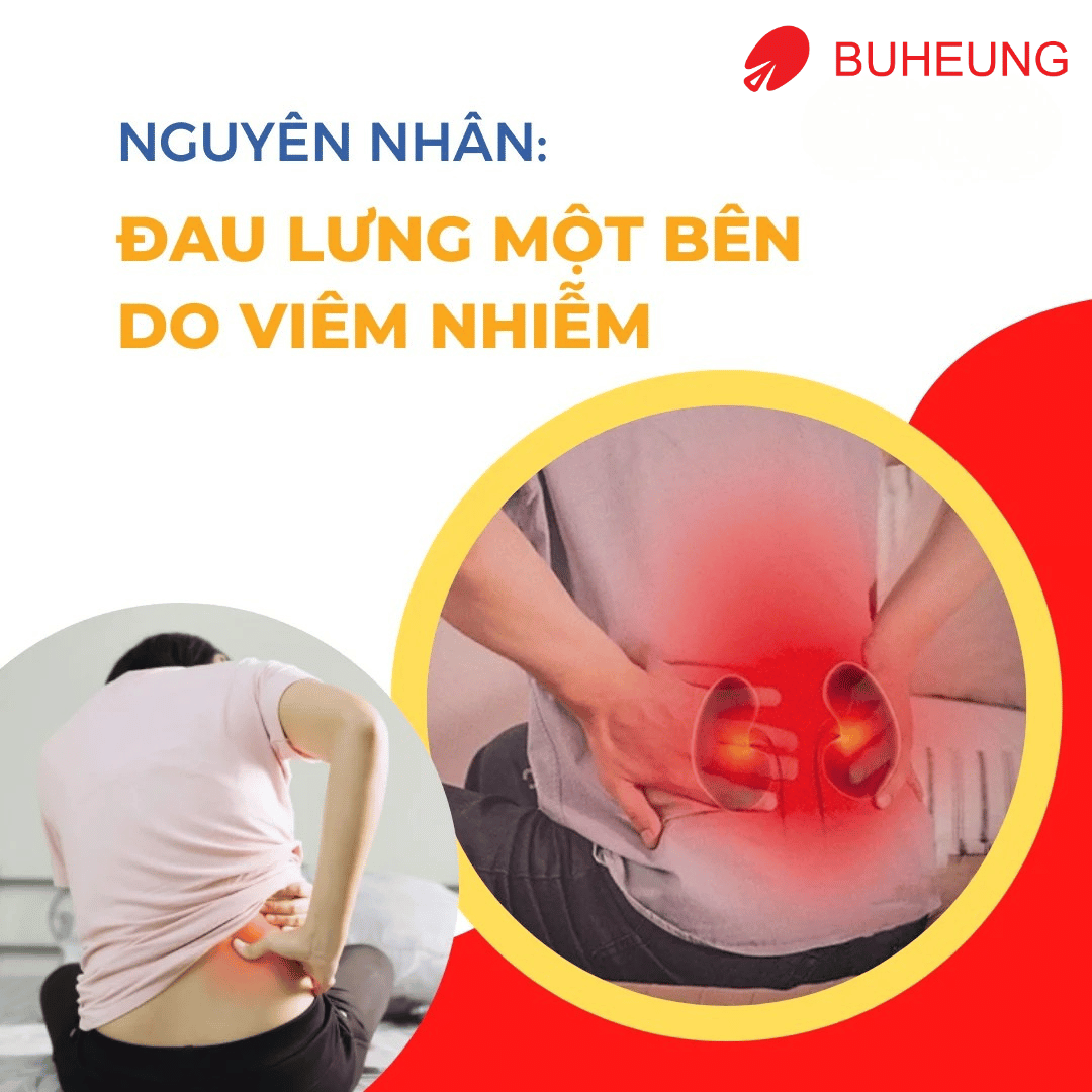 5 Nguyên Nhân Gây Đau Lưng Một Bên: Đau Lưng Bên Phải, Bên Trái 3 5 Nguyên Nhân Gây Đau Lưng Một Bên: Đau Lưng Bên Phải, Bên Trái 3
