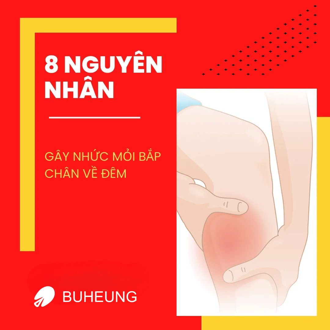 Nhức Mỏi Bắp Chân Về Đêm Nguy Hiểm Không: Dấu Hiệu, 8 Nguyên Nhân, Cách Giảm Nhức Mỏi 2