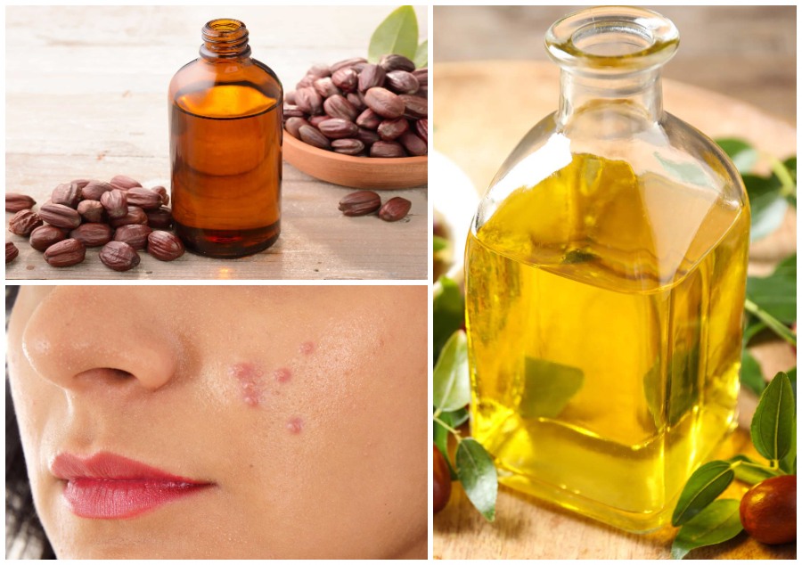 8 Loại Dầu Mát Xa Toàn Thân Hiệu Quả & Công Dụng 7