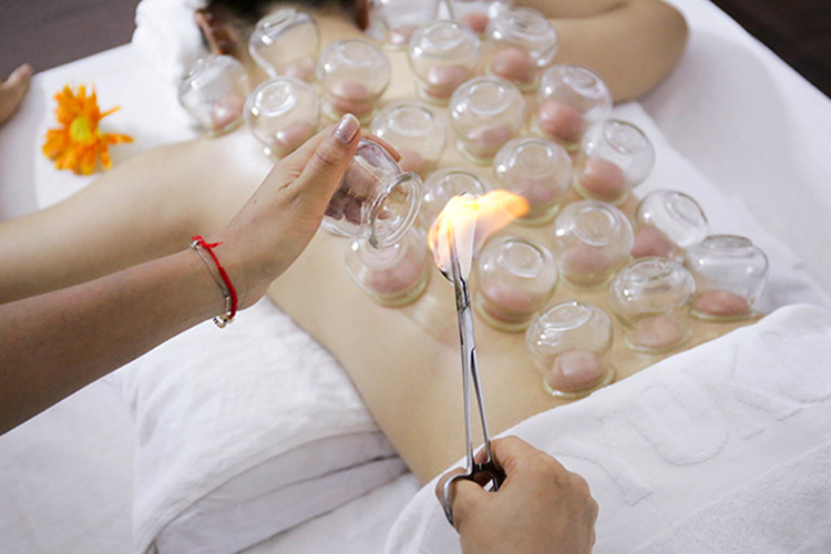 Cạo Gió Giác Hơi Là Gì: Công Dụng, Có Tốt Không 1