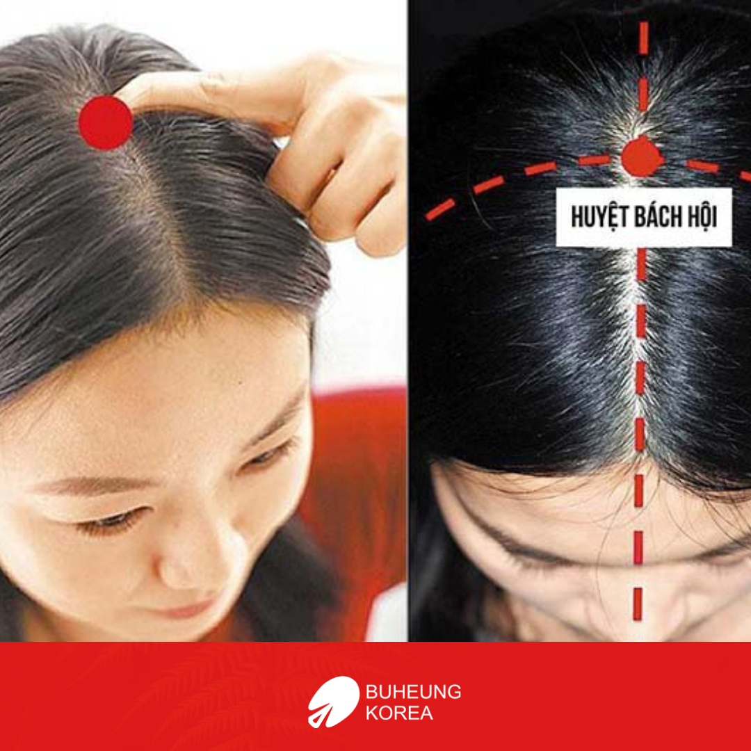 7 Bài Bấm Huyệt Chữa Đau Đầu Hiệu Quả Nhanh Chóng Tại Nhà 5