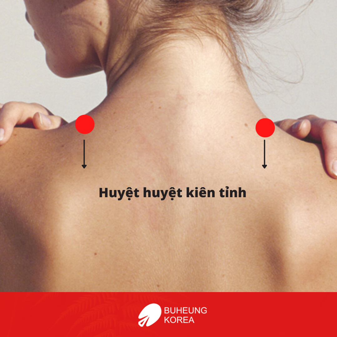 7 Bài Bấm Huyệt Chữa Đau Đầu Hiệu Quả Nhanh Chóng Tại Nhà 4