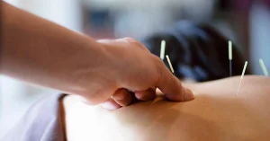 Châm Cứu Bấm Huyệt Là Gì: Công Dụng, Nhược Điểm 42