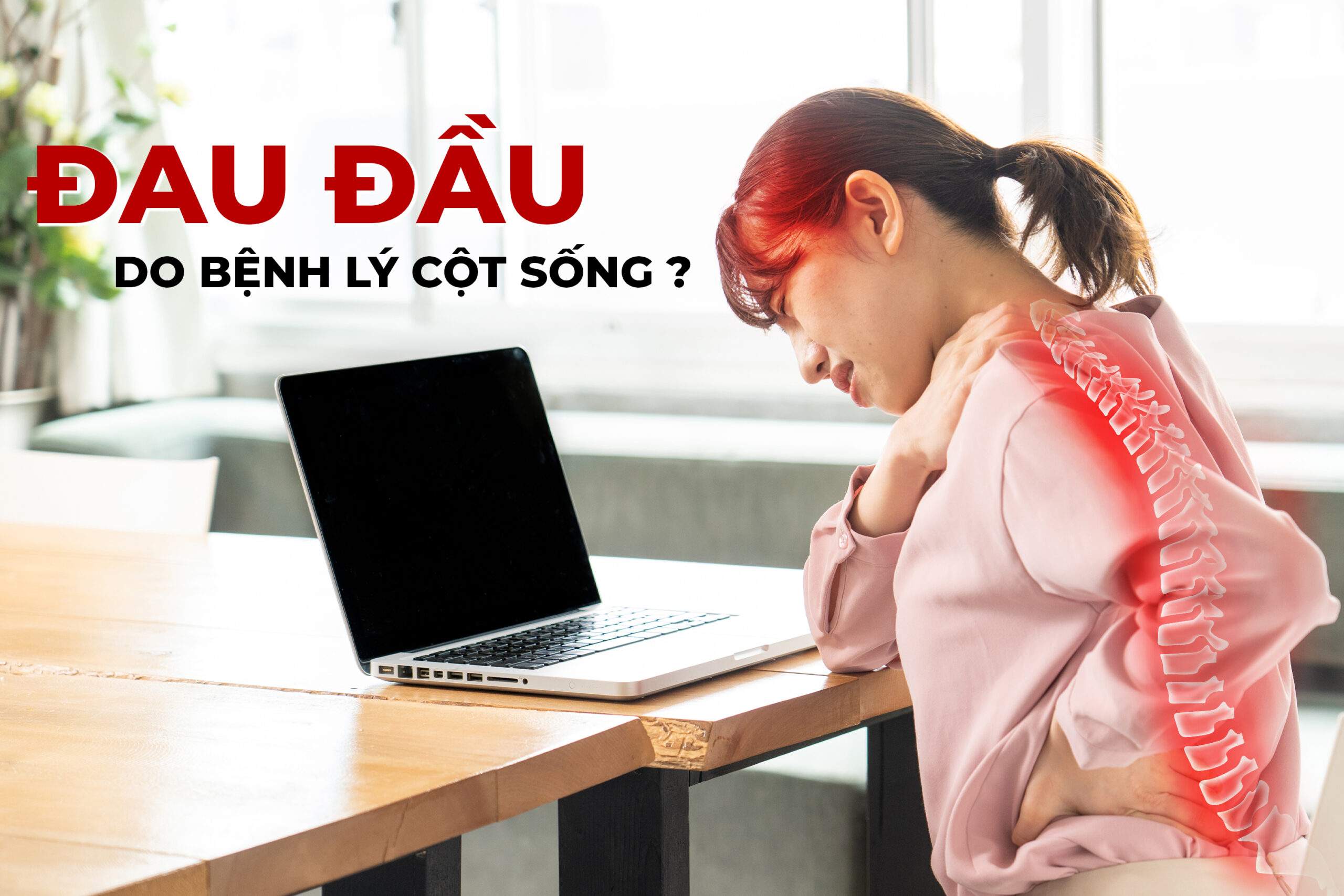 Cách Uống Thuốc Giảm Đau Đầu Tại Nhà Hiệu Quả An Toàn 2