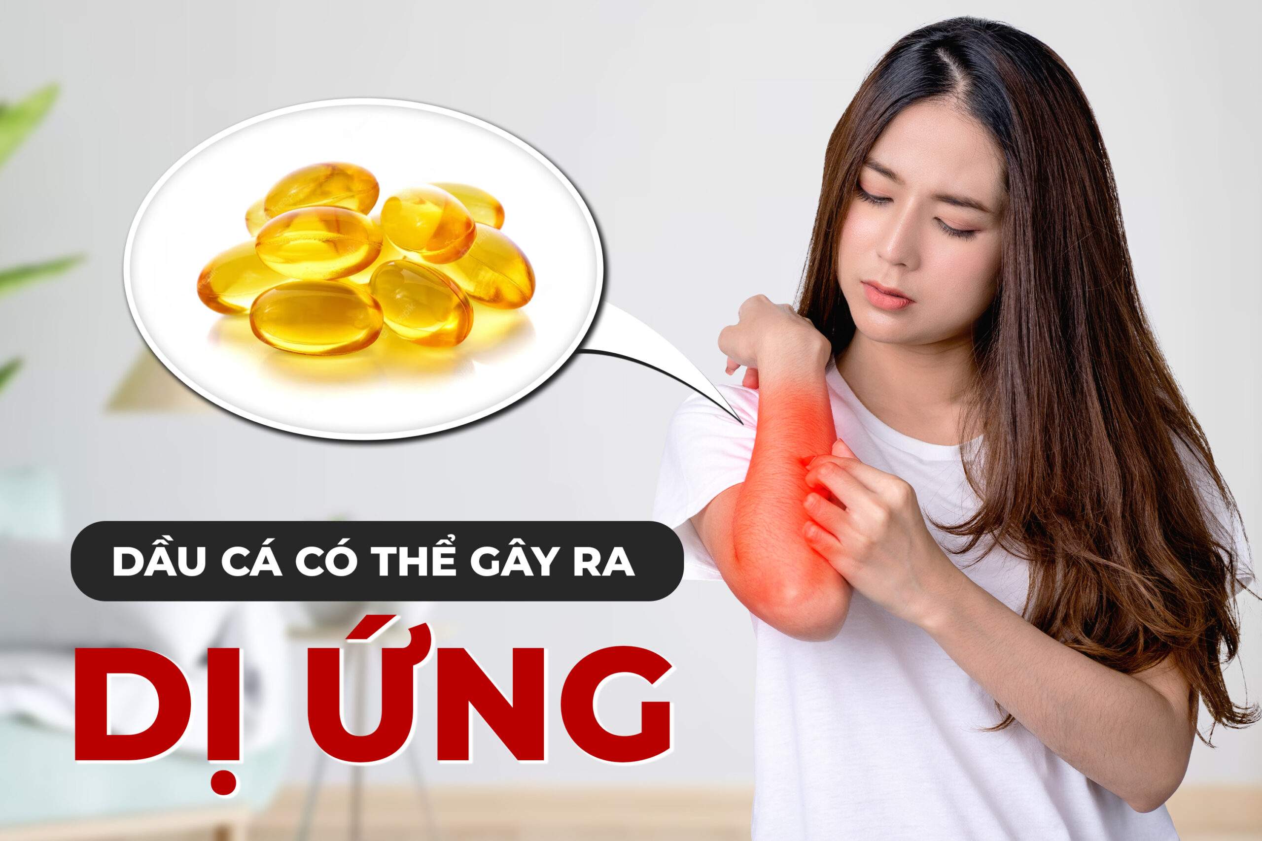 9 Tác Dụng Phụ Của Dầu Cá Phải Biết Khi Sử Dụng 4 Minh họa dị ứng khi uống dầu cá
