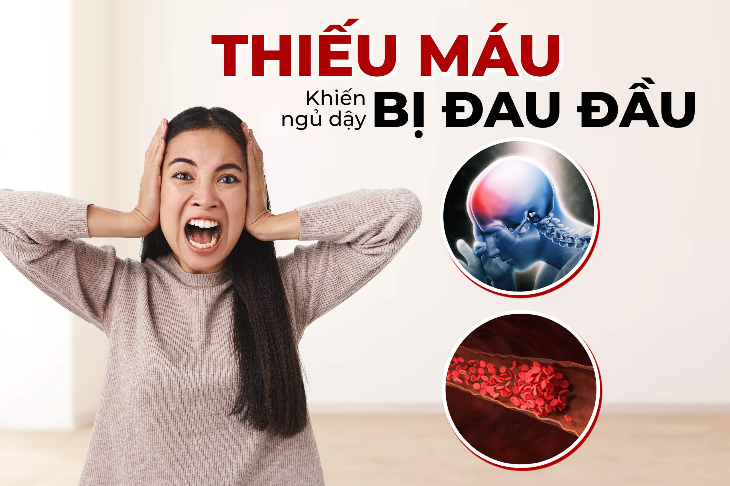 Vì Sao Ngủ Dậy Bị Đau Đầu? Cách Giảm Đau Đầu Khi Ngủ Dậy 3 Vì Sao Ngủ Dậy Bị Đau Đầu? Cách Giảm Đau Đầu Khi Ngủ Dậy 3