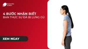 Minh họa 4 cách nhận biết gù lưng