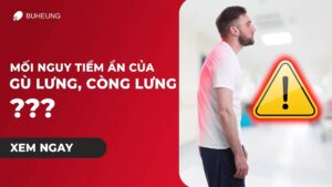 Mối Nguy Tiềm Ẩn Của Gù Lưng, Cong Lưng 10