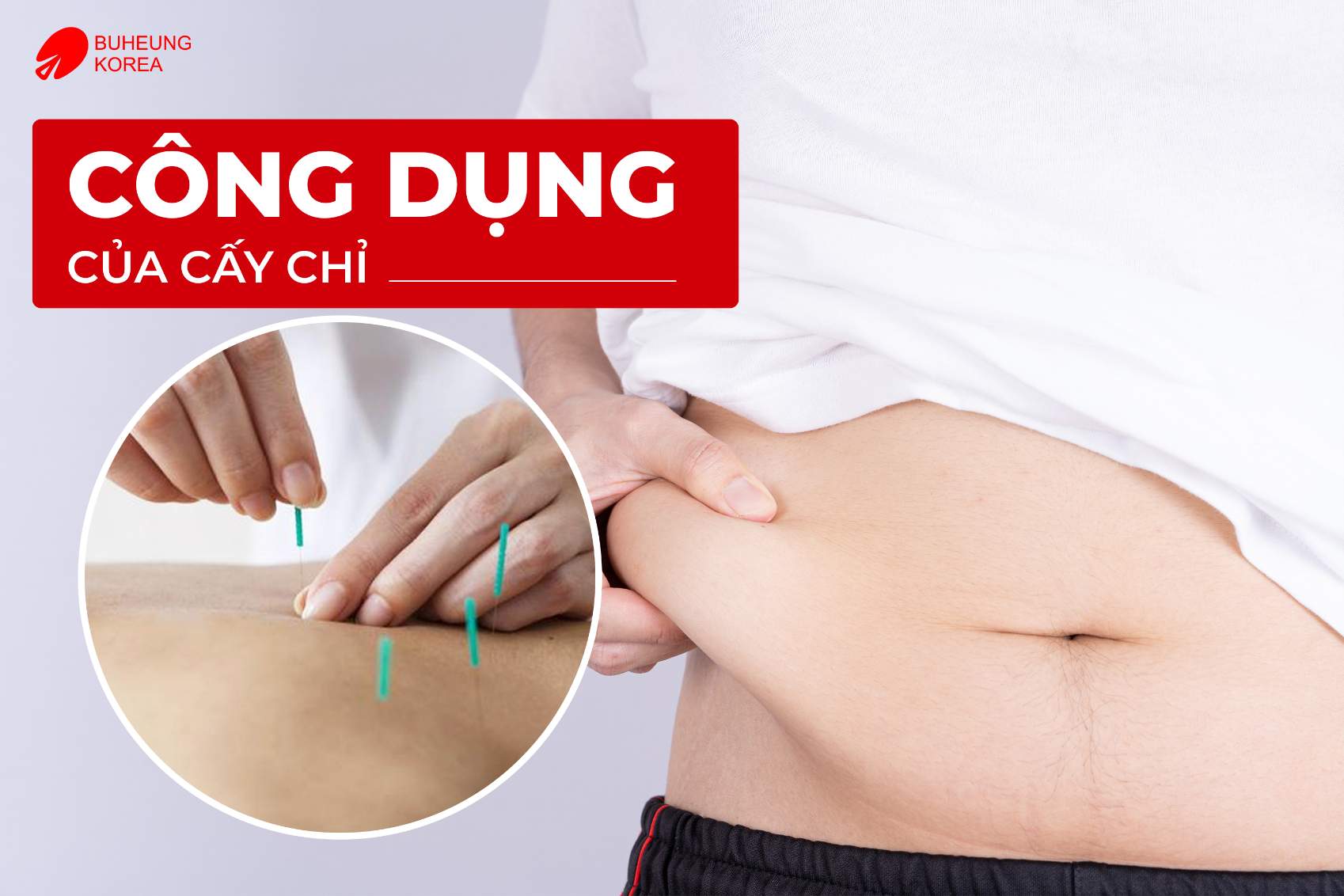 Phương Pháp Cấy Chỉ Huyệt Đạo Có Tốt Không? Có Nên Làm 3 Minh họa công dụng của cấy chỉ