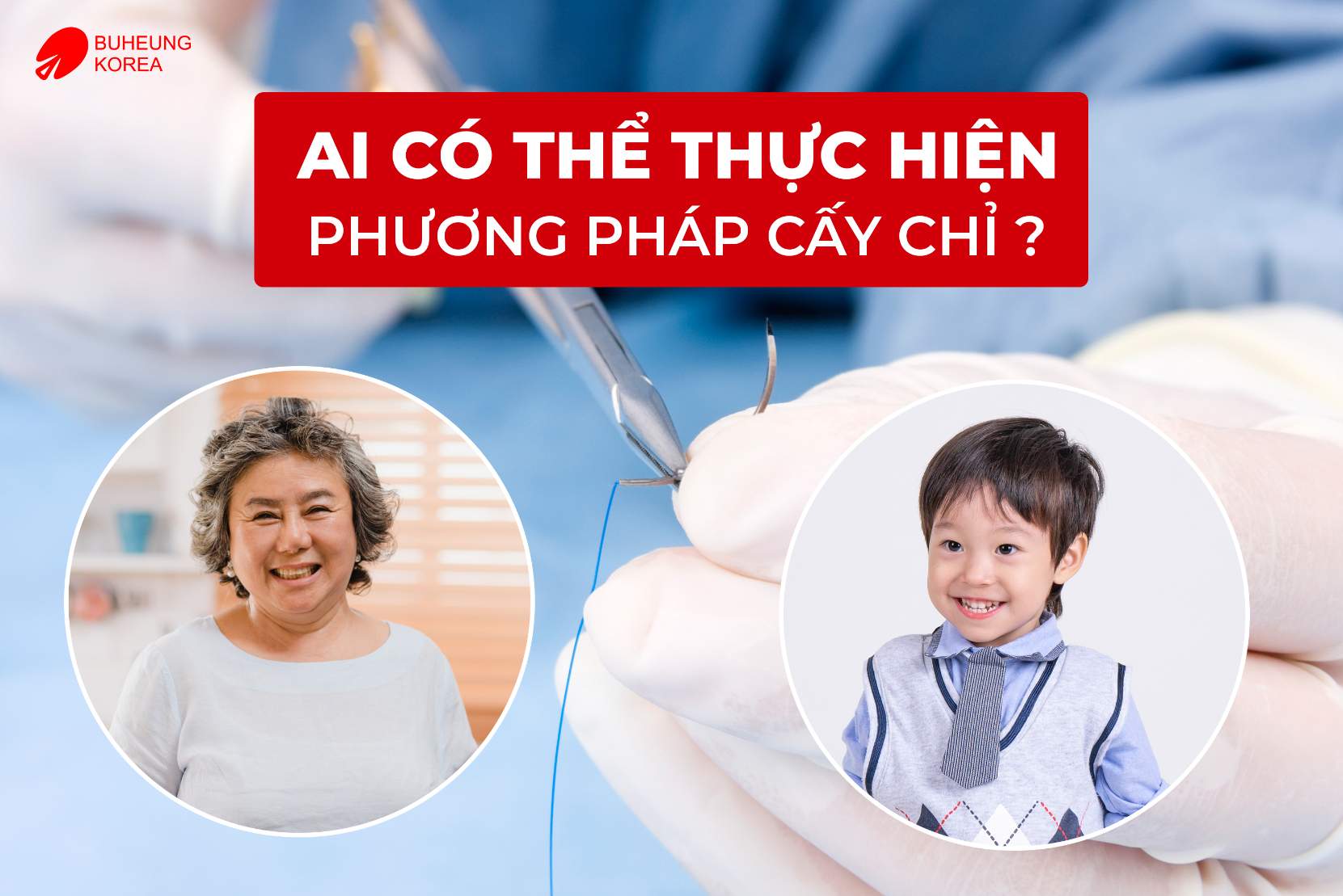 Phương Pháp Cấy Chỉ Huyệt Đạo Có Tốt Không? Có Nên Làm 4 Minh họa đối tượng thực hiện được cấy chỉ