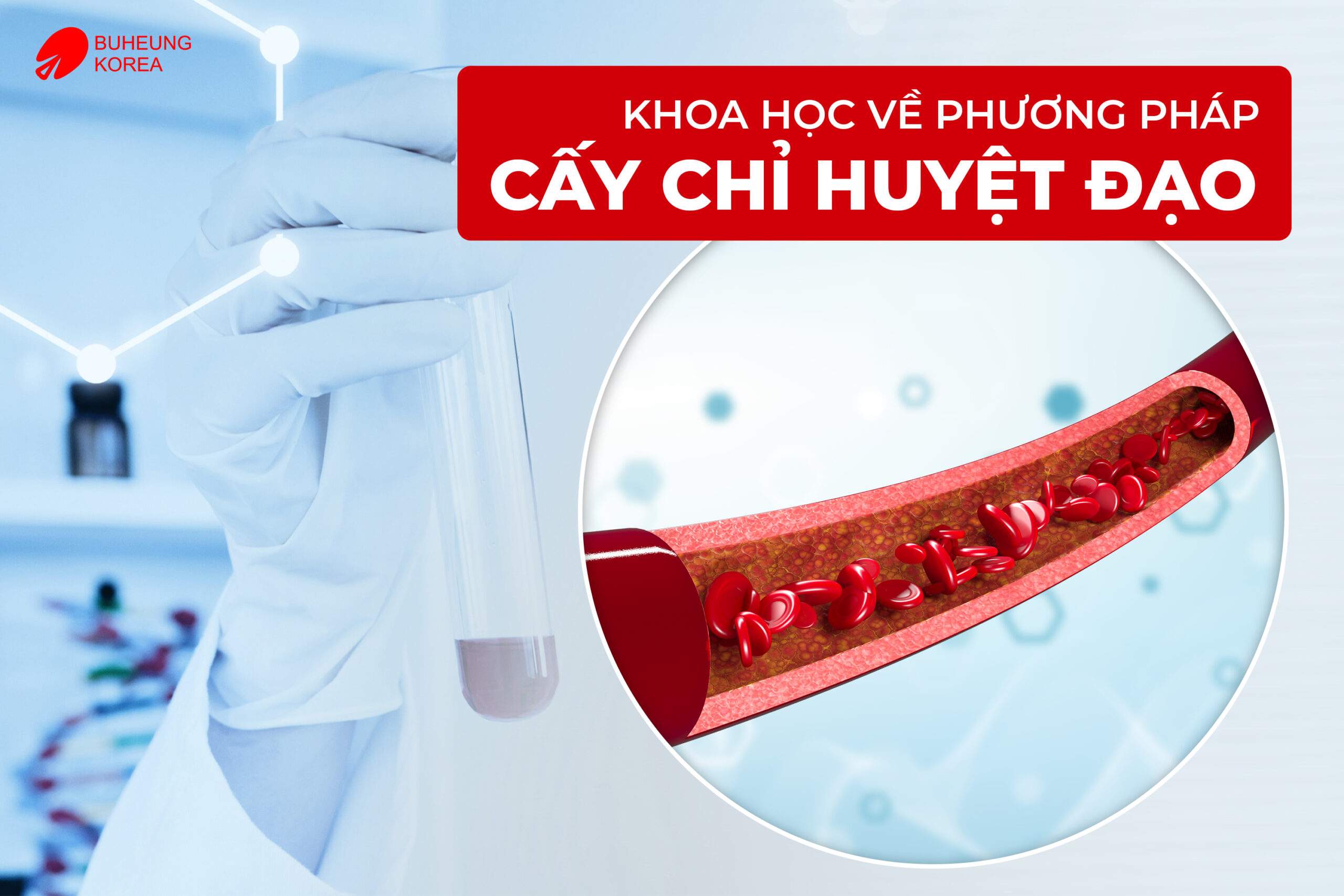 Phương Pháp Cấy Chỉ Huyệt Đạo Có Tốt Không? Có Nên Làm 2 Minh họa tính khoa học của phương pháp cấy chỉ