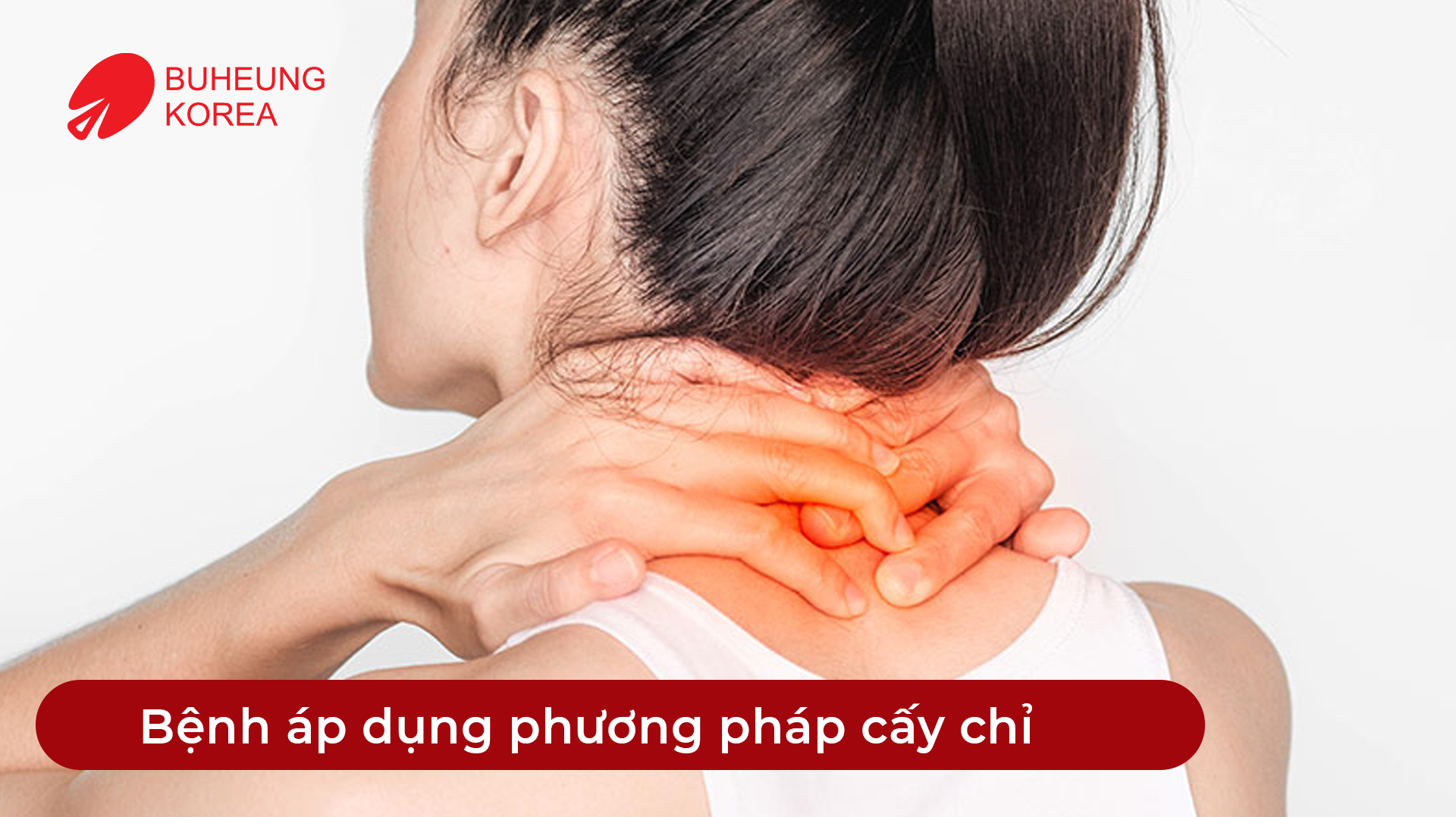 Minh họa các bệnh có thể áp dụng cấy chỉ