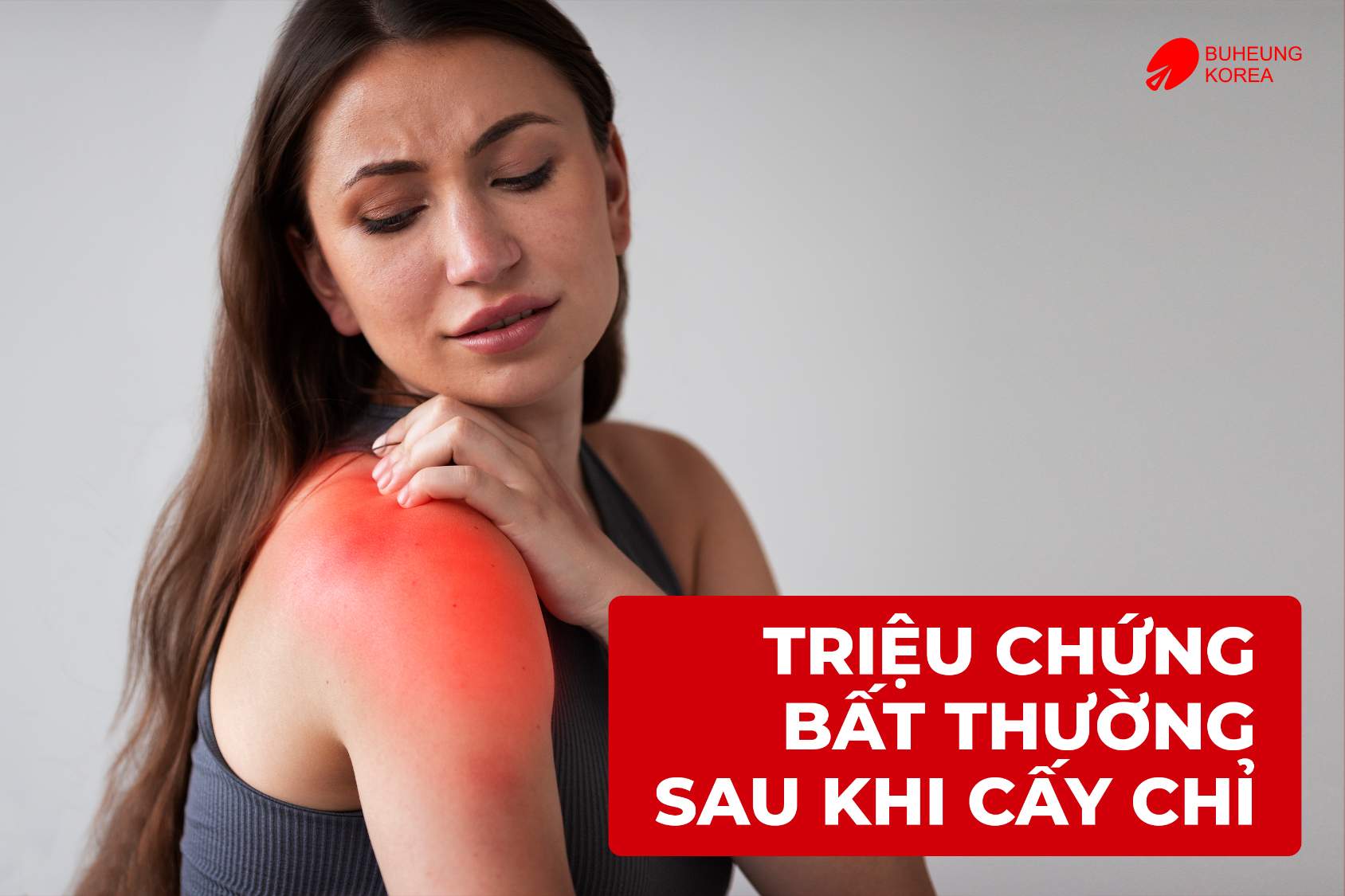 7 Triệu Chứng Bất Thường Sau Khi Cấy Chỉ Cần Theo Dõi 3 Minh họa triệu chứng bất thường - Dị ứng sau cấy chí