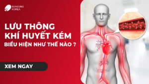 Minh họa biểu hiện lưu thông khí huyết kém