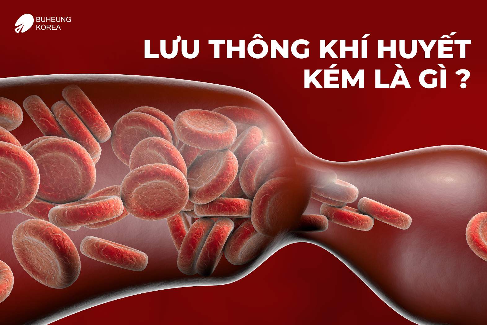 Lưu Thông Khí Huyết Kém Biểu Hiện Như Thế Nào 2 Minh họa lưu thông khí huyết kém