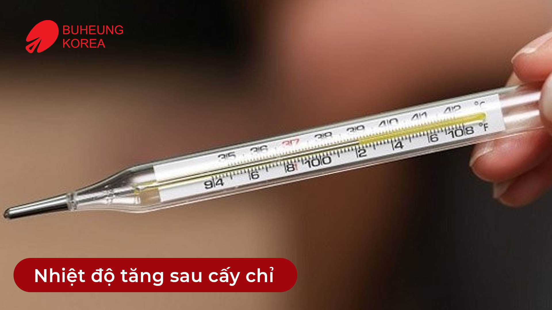 Minh họa nhiệt độ cơ thể tăng sau cấy chỉ