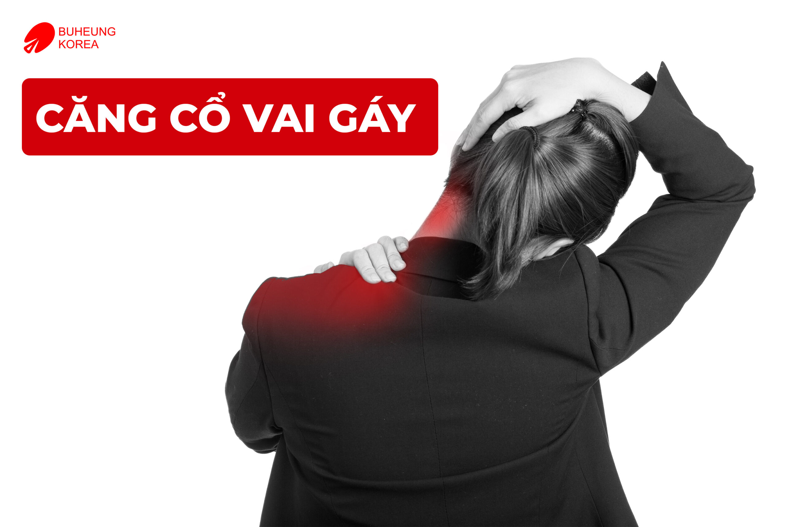 Giảm Căng Cơ Cổ Nhanh Chóng & Các Phòng Tránh 3 Minh họa căng cơ vùng cổ vai gáy