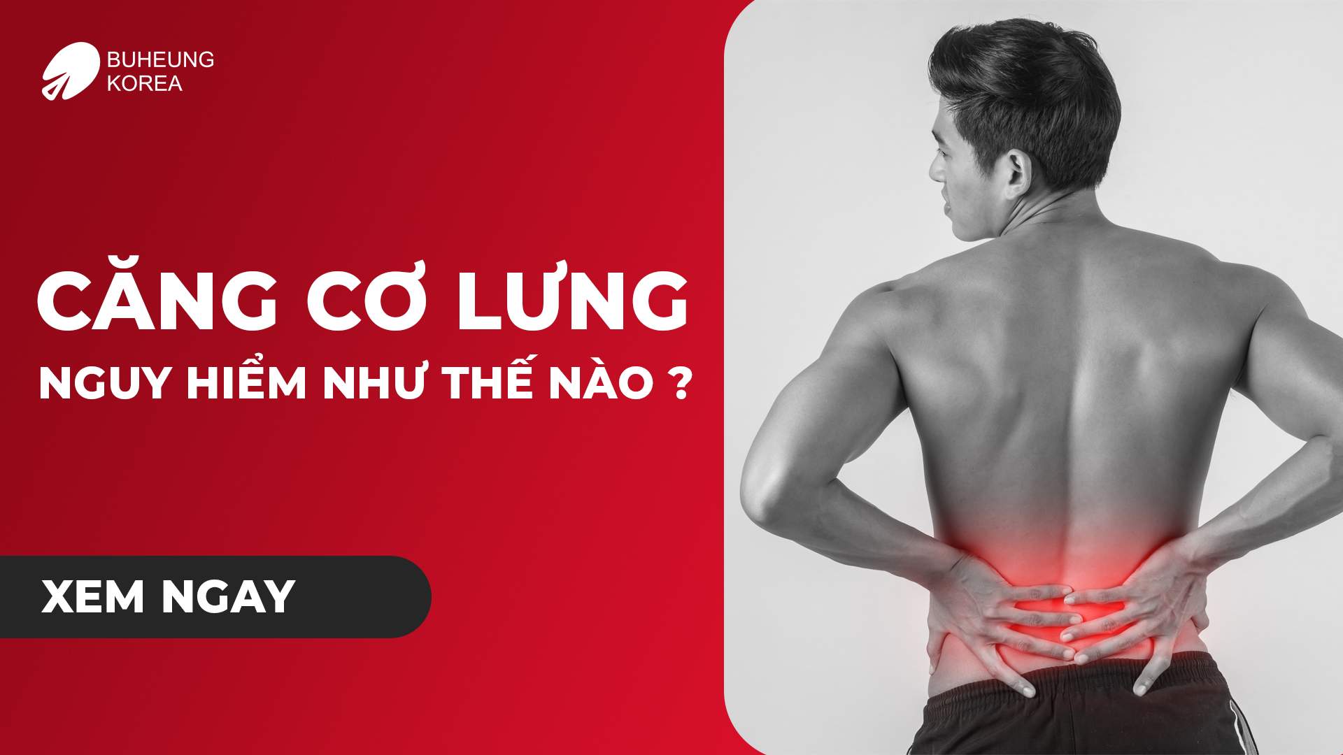 Căng Cơ Lưng Nguy Hiểm Như Thế Nào? Cách Giảm Căng Cơ Lưng 1 Minh họa căng cơ lưng