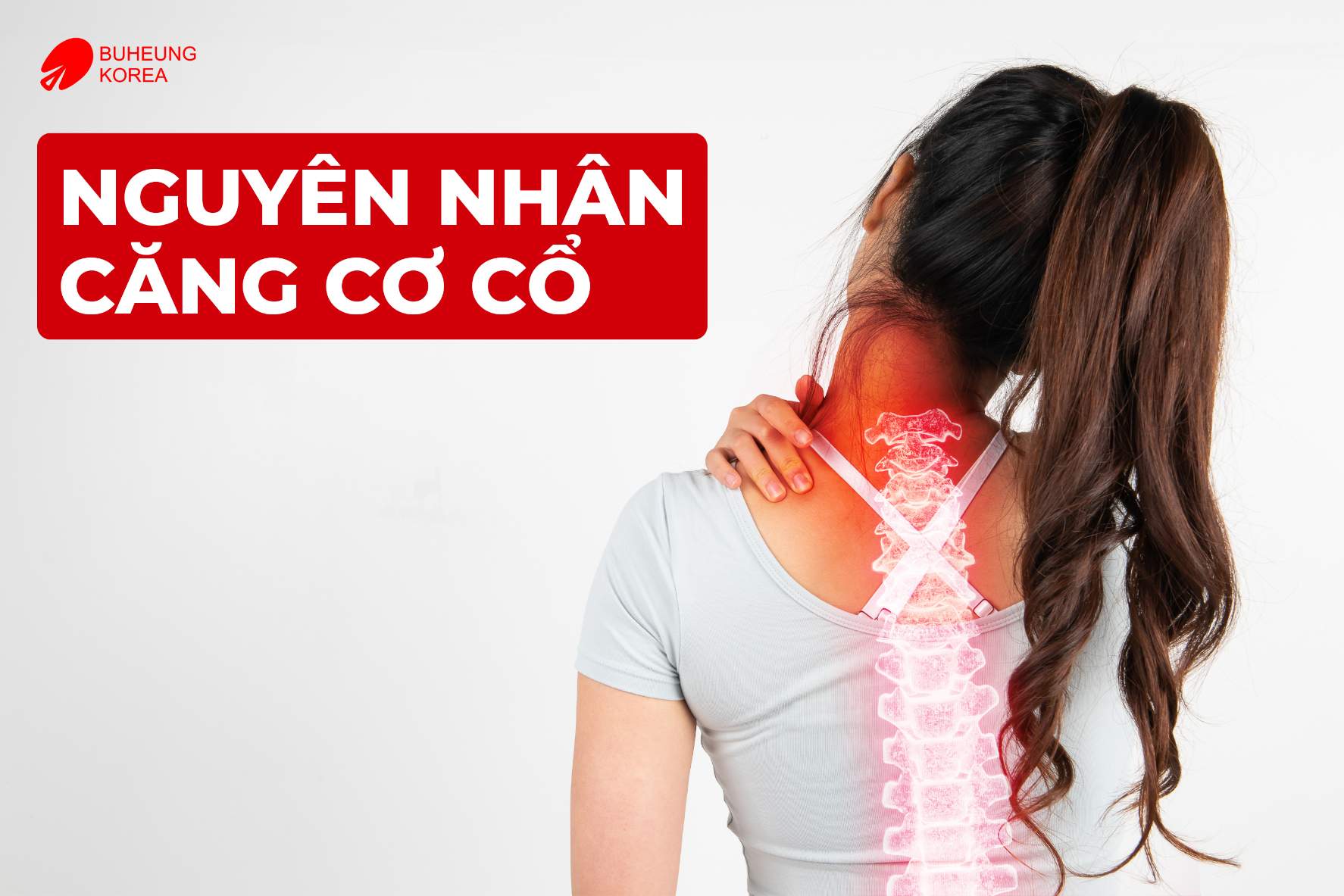 Giảm Căng Cơ Cổ Nhanh Chóng & Các Phòng Tránh 2 Minh họa nguyên nhân gây căng cơ cổ
