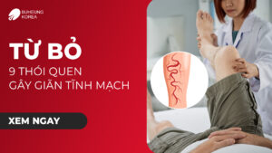 Từ Bỏ 9 Thói Quen Gây Giãn Tĩnh Mạch Chân 50
