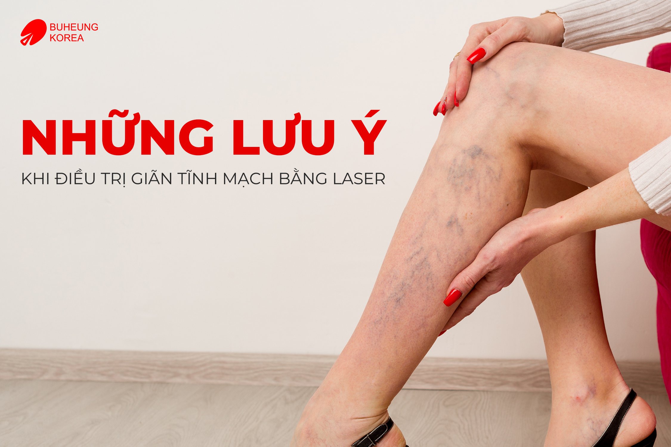 Chi Phí Điều Trị Giãn Tĩnh Mạch Bằng Laser 5 Chi Phí Điều Trị Giãn Tĩnh Mạch Bằng Laser 5