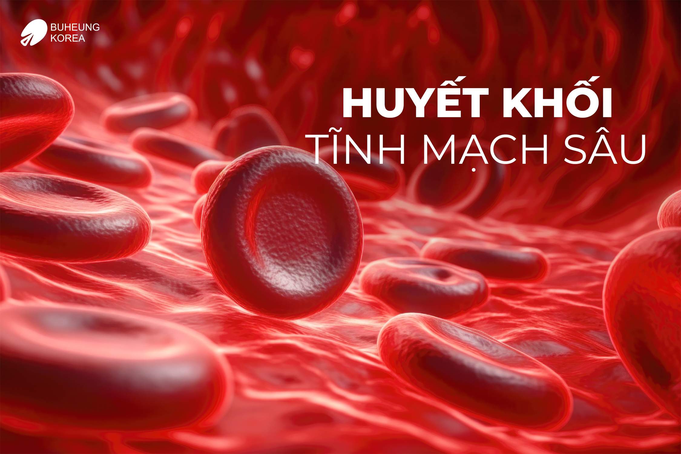 Giãn Tĩnh Mạch Bàn Chân Có Nguy Hiểm Không? 3