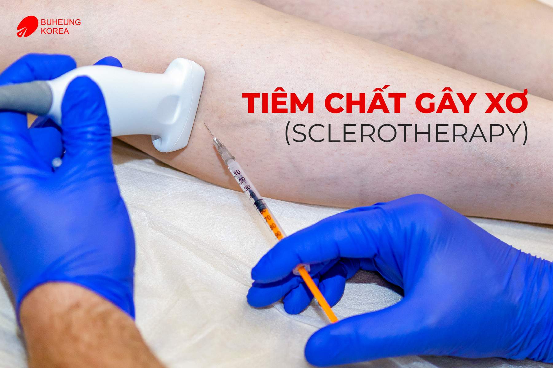 Giãn Tĩnh Mạch Bàn Chân Có Nguy Hiểm Không? 8