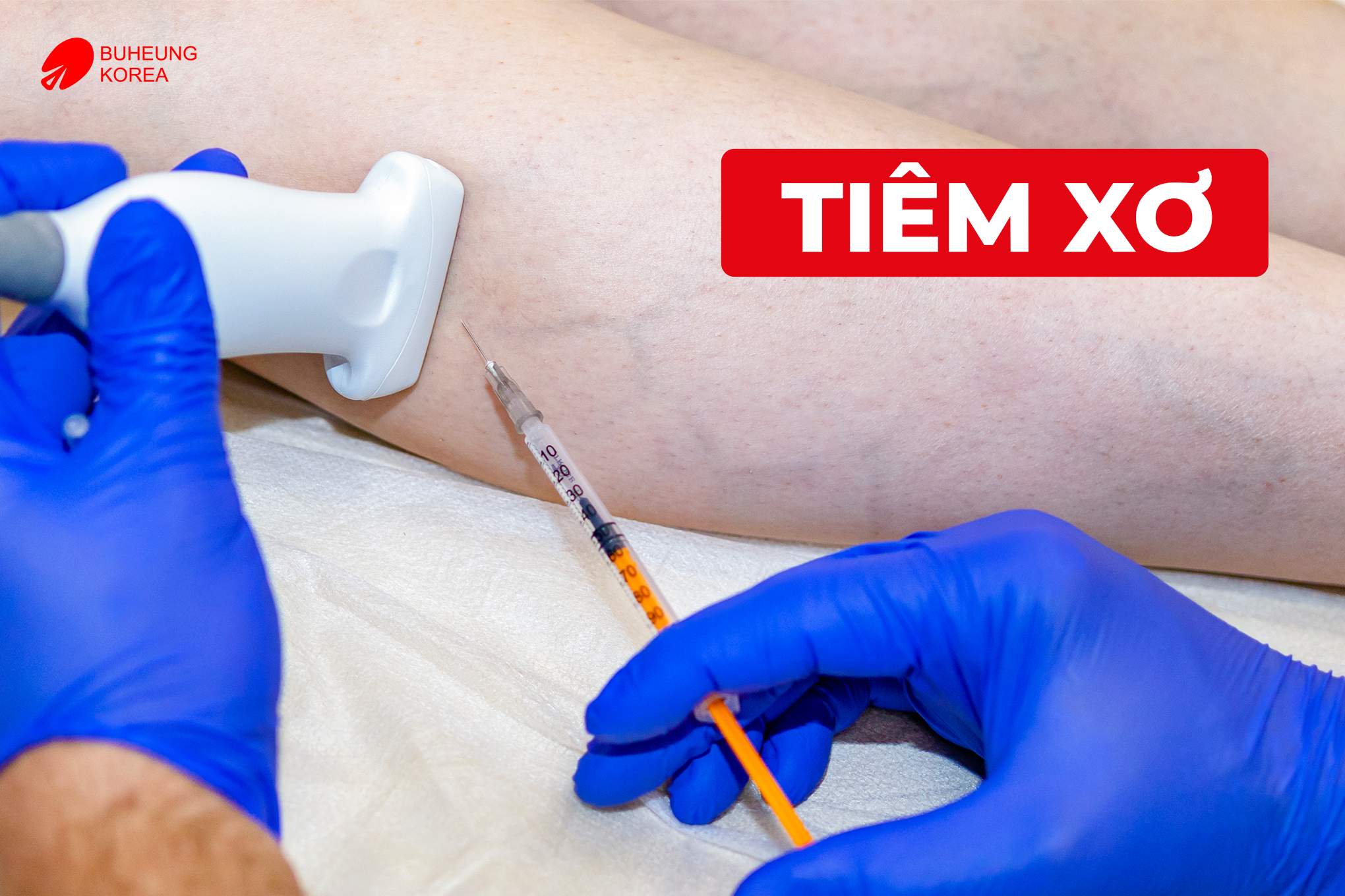 Giãn Tĩnh Mạch Chi Dưới Có Chữa Được Không? 3