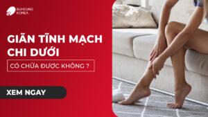 Giãn Tĩnh Mạch Chi Dưới Có Chữa Được Không? 71