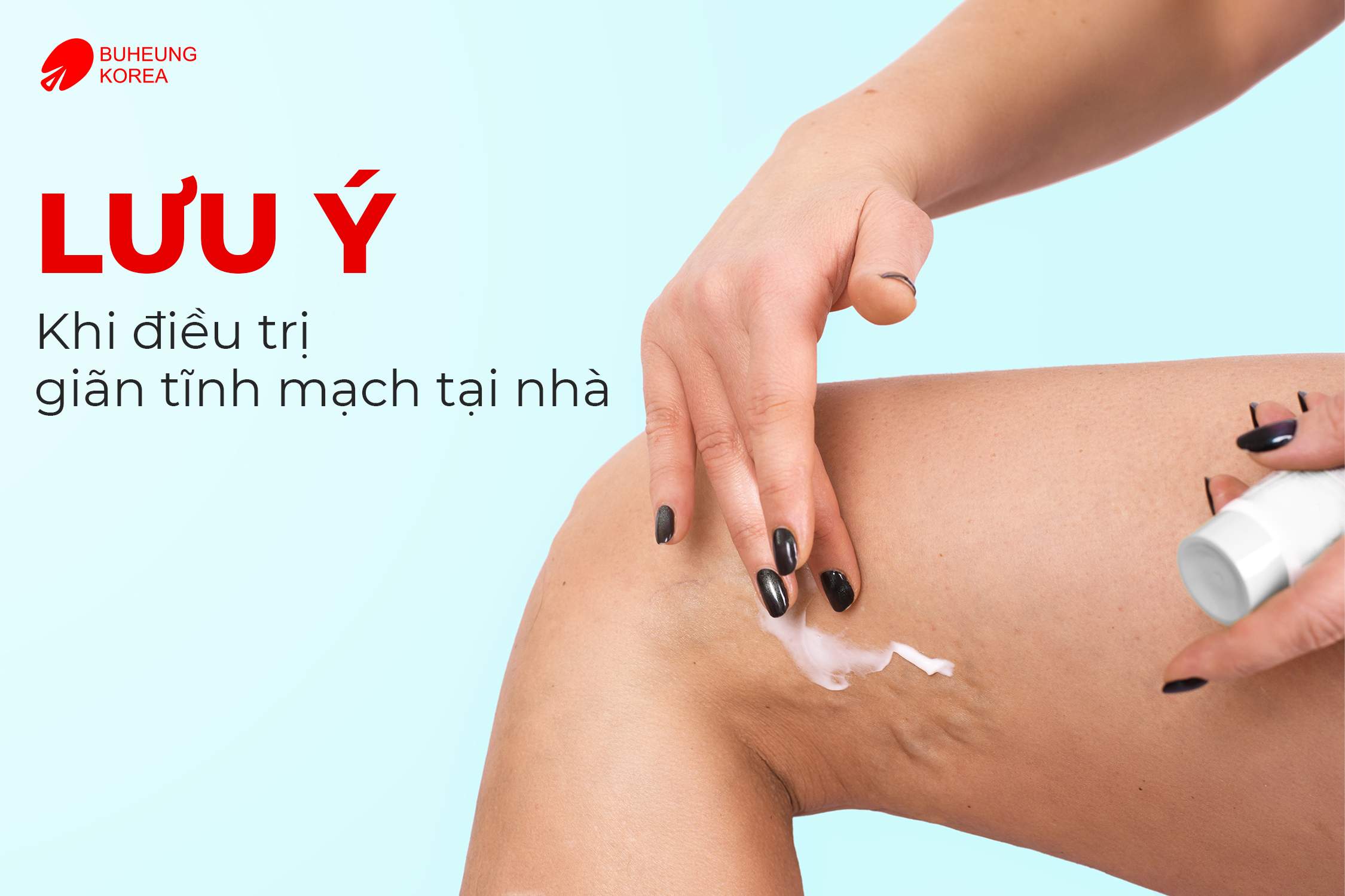 Nguyên Nhân Và Cách Trị Giãn Tĩnh Mạch Chân Tại Nhà 5