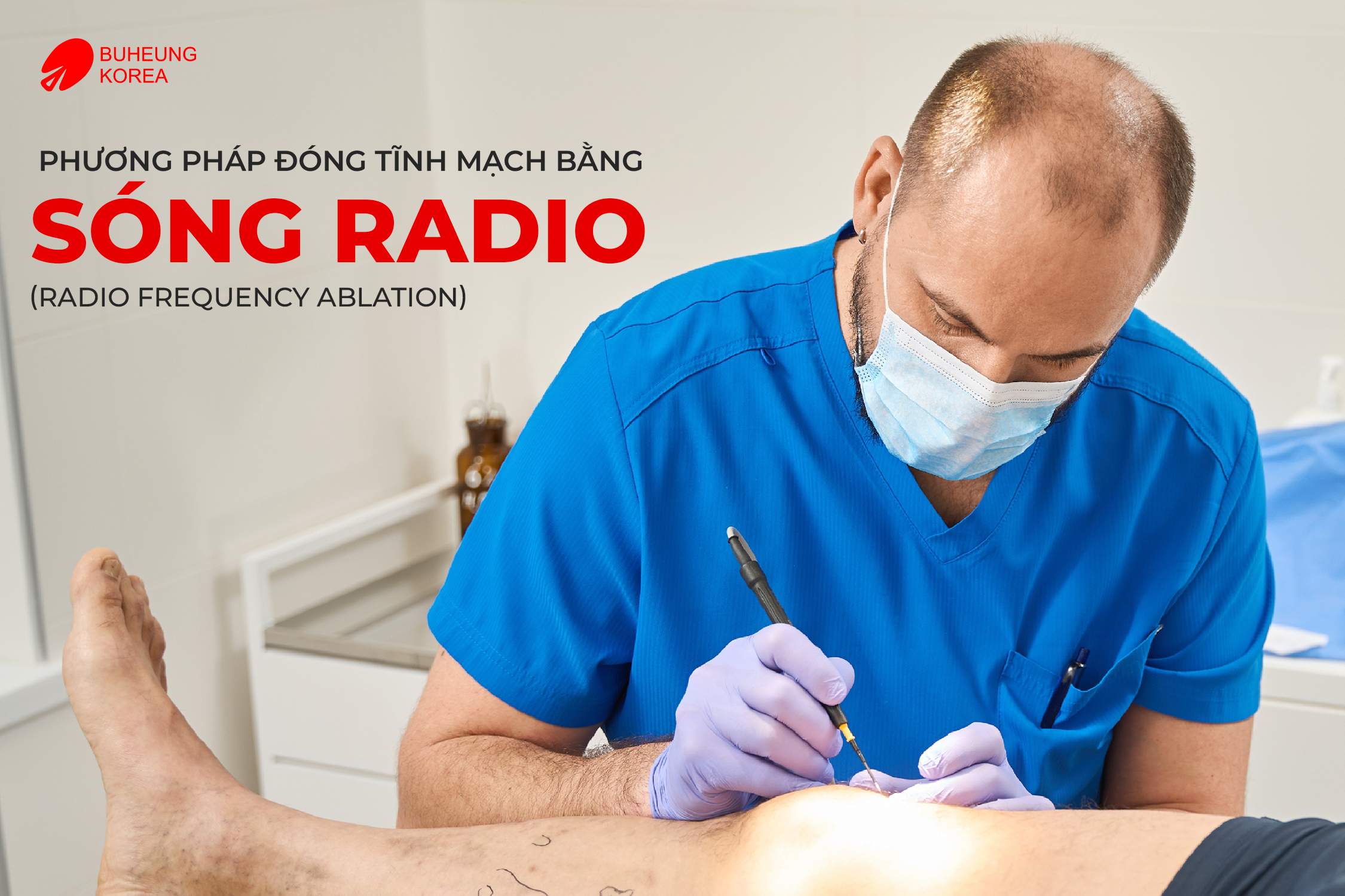 Chi Phí Điều Trị Giãn Tĩnh Mạch Bằng Laser 2 Chi Phí Điều Trị Giãn Tĩnh Mạch Bằng Laser 2