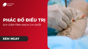 Phác Đồ Điều Trị Giãn Tĩnh Mạch Chi Dưới 29 Phác Đồ Điều Trị Giãn Tĩnh Mạch Chi Dưới 29