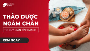 Top 5 Thảo Dược Ngâm Chân Trị Suy Giãn Tĩnh Mạch 79