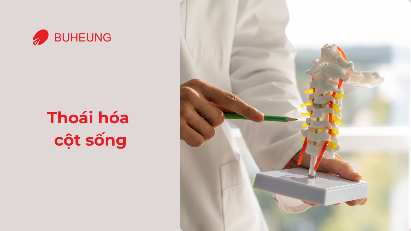 5 Căn Bệnh Cơ Xương Khớp Đang Rình Rập Dân Văn Phòng 3