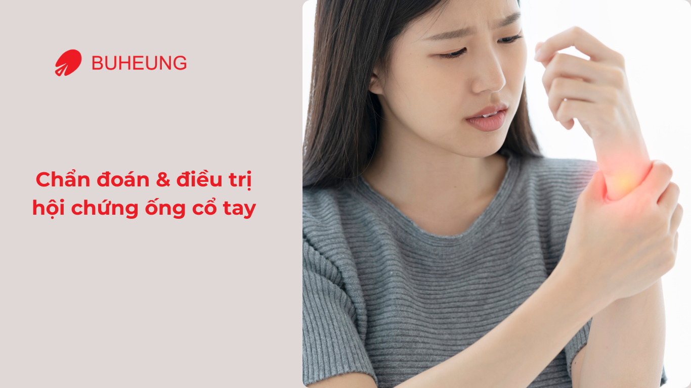 Hội Chứng Ống Cổ Tay Ở Dân Văn Phòng Là Gì?  4