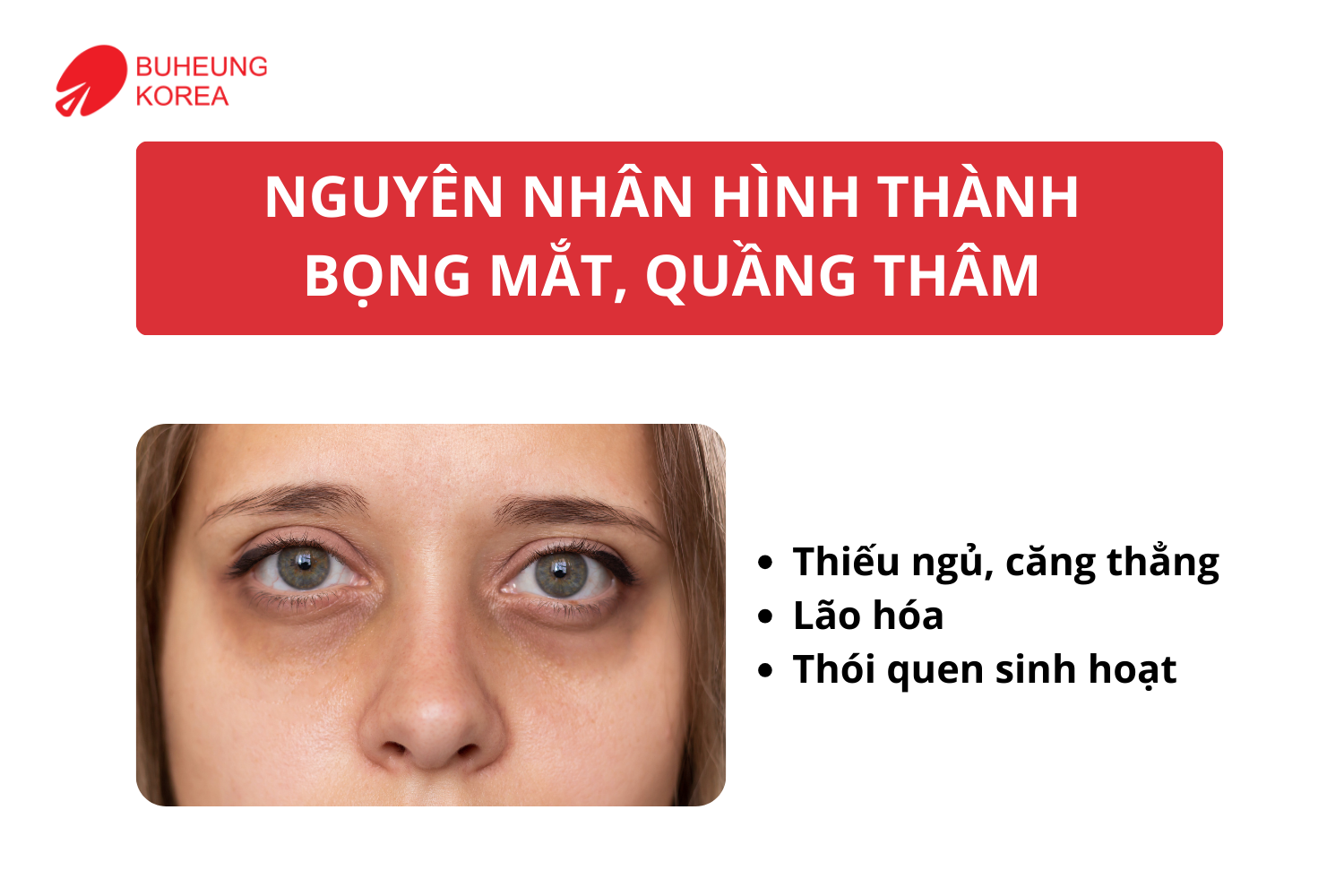 Cách Giảm Bọng Mắt, Quầng Thâm Bằng Massage Đầu Và Thái Dương 1