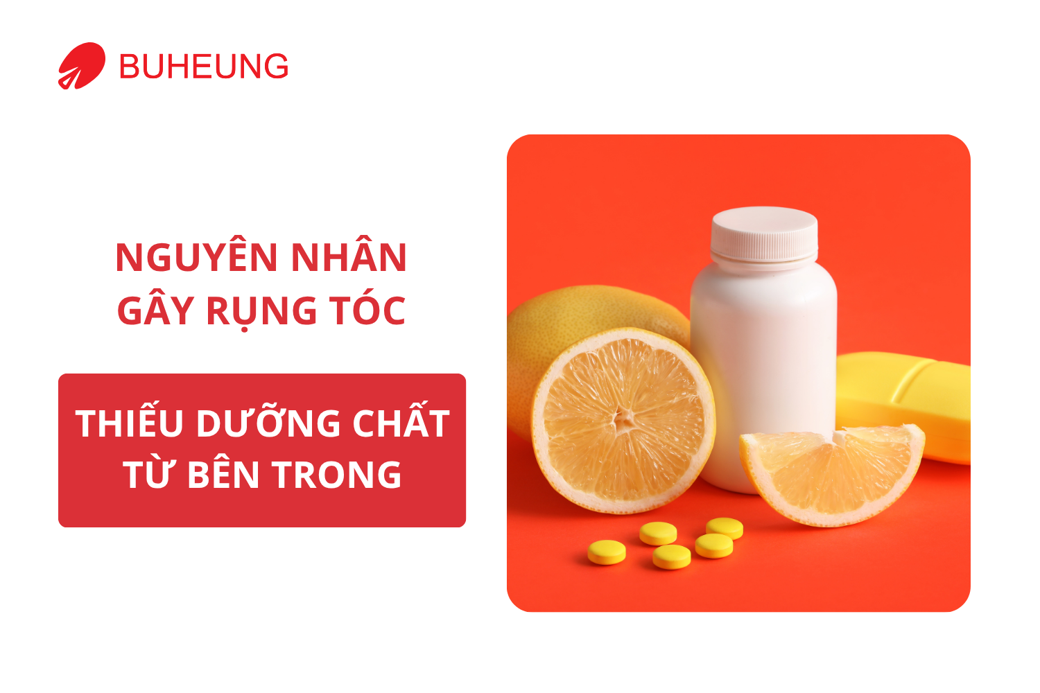 7 Nguyên Nhân Khiến Bạn Rụng Tóc Nhiều Mỗi Ngày 2