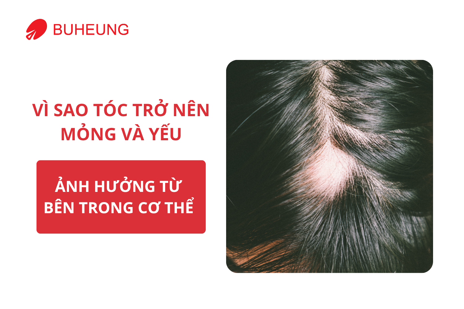 Tóc Mỏng Yếu Và Cách Cải Thiện Tự Nhiên 1