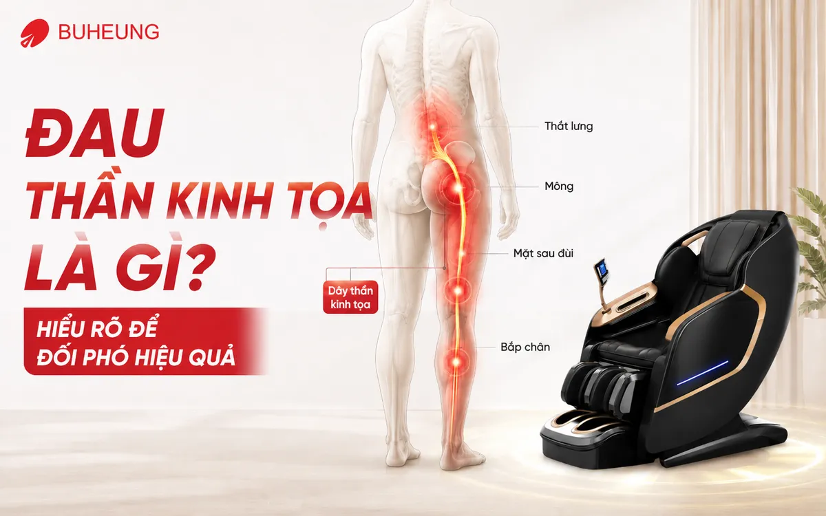 Sơ đồ giải phẫu chi tiết minh họa vị trí dây thần kinh tọa và các vùng đau điển hình trên cơ thể người.